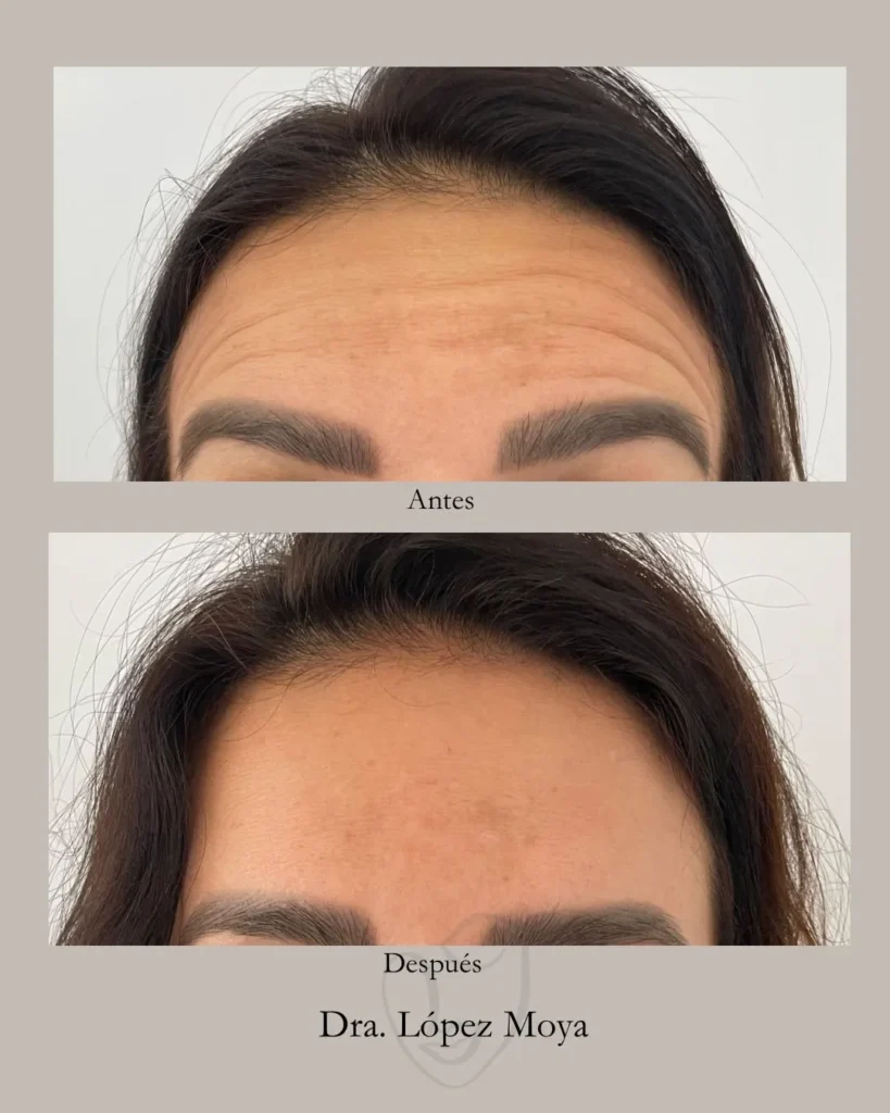 medicina estética en almería