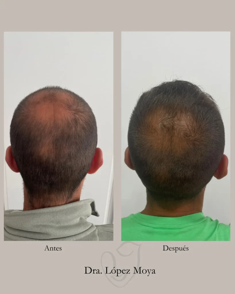 medicina estética en almería