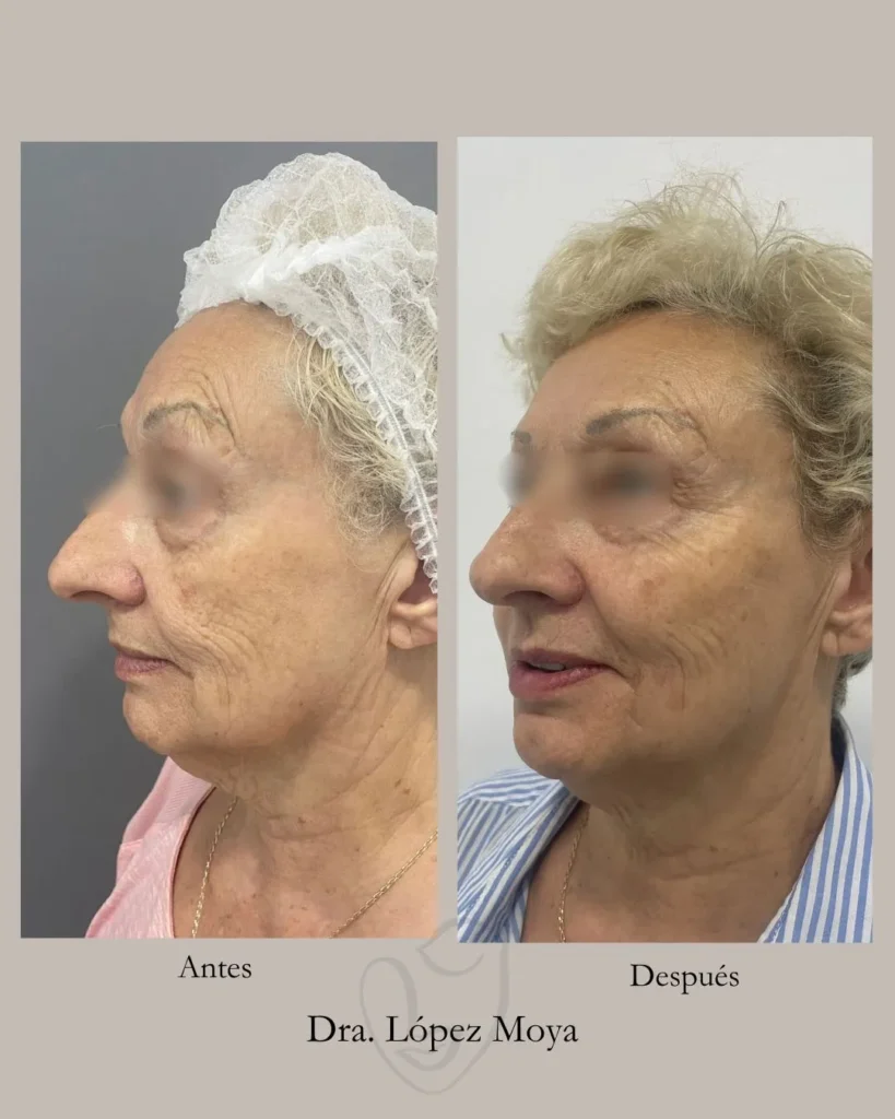 medicina estética en almería