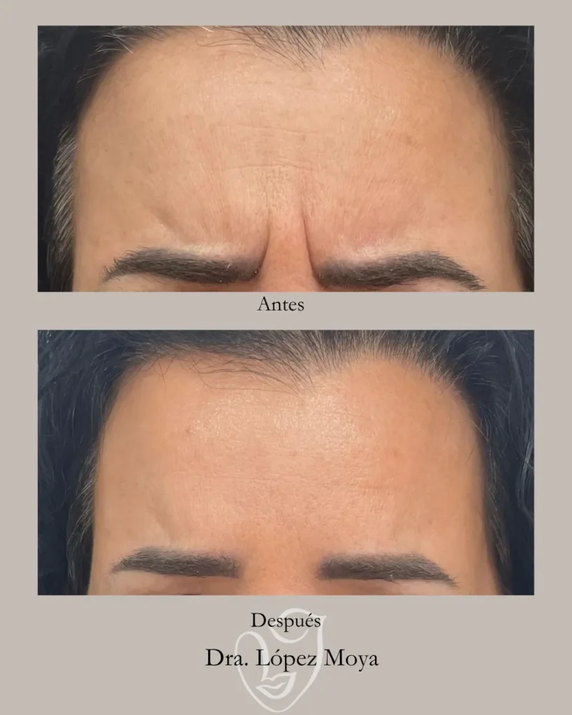 medicina estética en almería