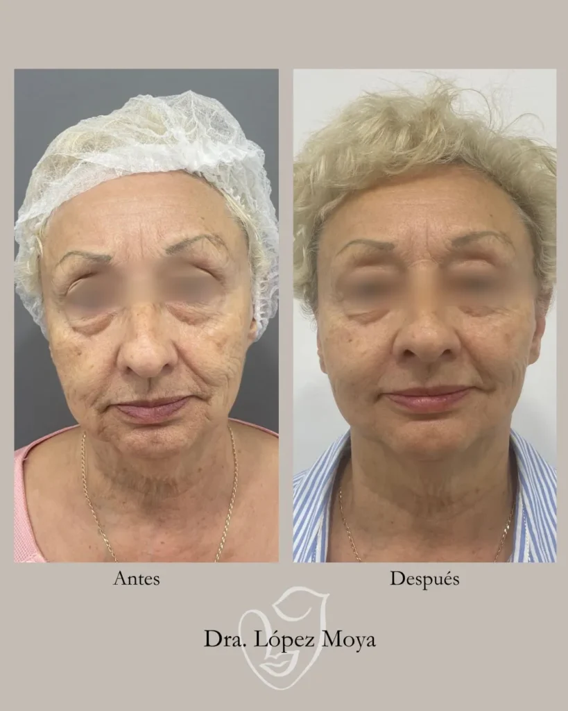 medicina estética en almería