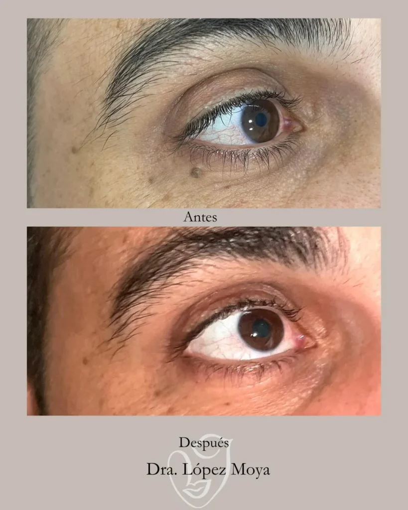 medicina estética en almería