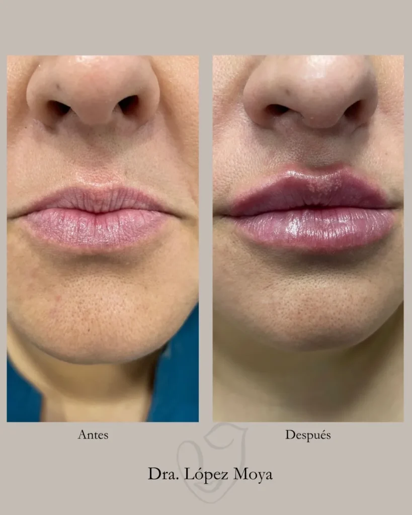 medicina estética en almería