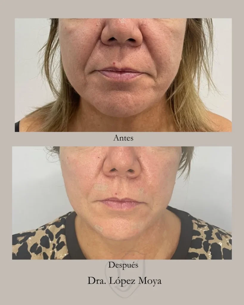 medicina estética en almería