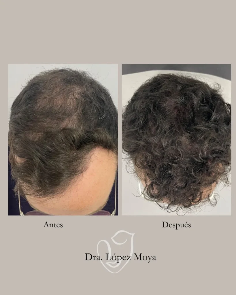 medicina estética en almería