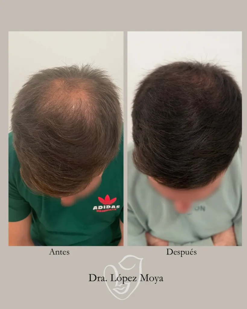 medicina estética en almería