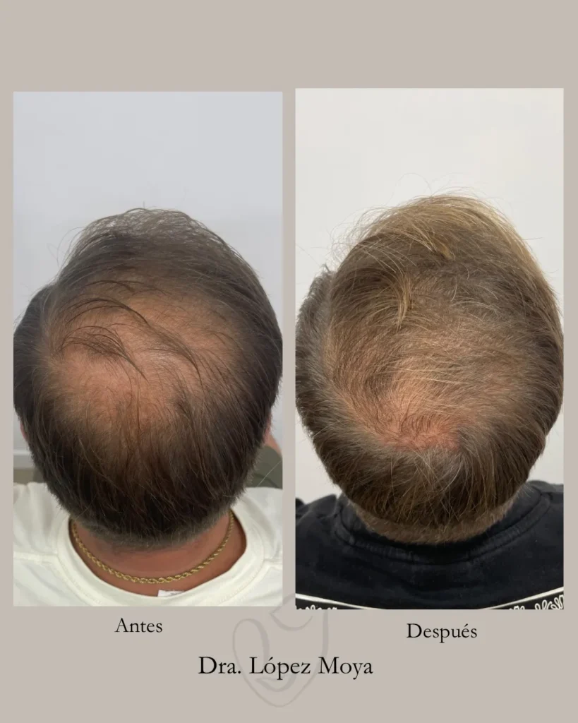 medicina estética en almería